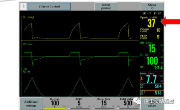 呼吸机呼气阀是什么医工实习：呼吸机的常用模式及故障_https://www.jmylbn.com_新闻资讯_第9张
