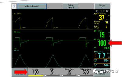呼吸机呼气阀是什么医工实习：呼吸机的常用模式及故障_https://www.jmylbn.com_新闻资讯_第7张