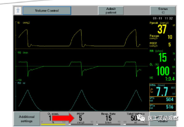 呼吸机呼气阀是什么医工实习：呼吸机的常用模式及故障_https://www.jmylbn.com_新闻资讯_第8张