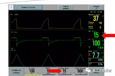 呼吸机呼气阀是什么医工实习：呼吸机的常用模式及故障_https://www.jmylbn.com_新闻资讯_第4张