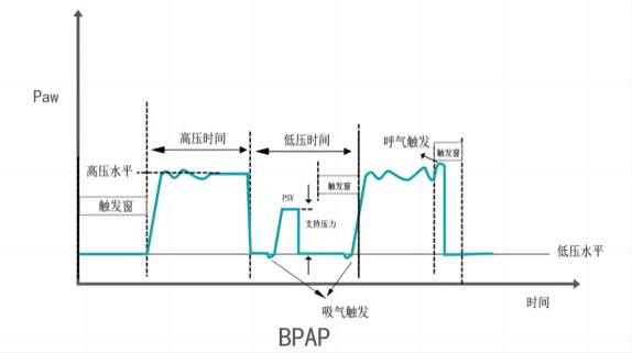 bipap是什么意思科普指南丨呼吸机BPAP模式在临床中的应用_https://www.jmylbn.com_新闻资讯_第3张