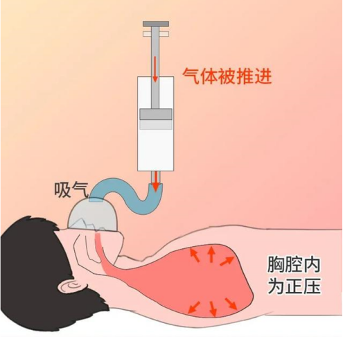 呼吸机是干什么的【呼吸专题】干货！呼吸机的基本结构介绍！_https://www.jmylbn.com_新闻资讯_第2张