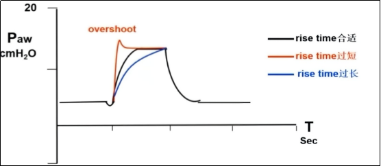 呼吸机ac是什么意思【收藏】有创呼吸机PCV模式详细解读！_https://www.jmylbn.com_新闻资讯_第7张