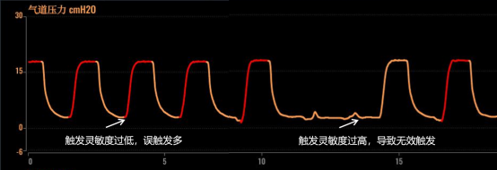 呼吸机ac是什么意思【收藏】有创呼吸机PCV模式详细解读！_https://www.jmylbn.com_新闻资讯_第6张