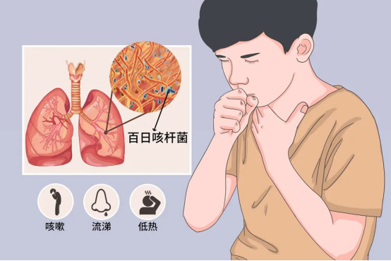 近期发病率上升!咳嗽严重,警惕患上百日咳