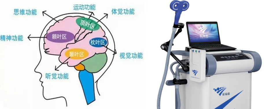 tms什么医疗【健康科普】经颅磁技术（TMS）的临床应用_https://www.jmylbn.com_新闻资讯_第2张
