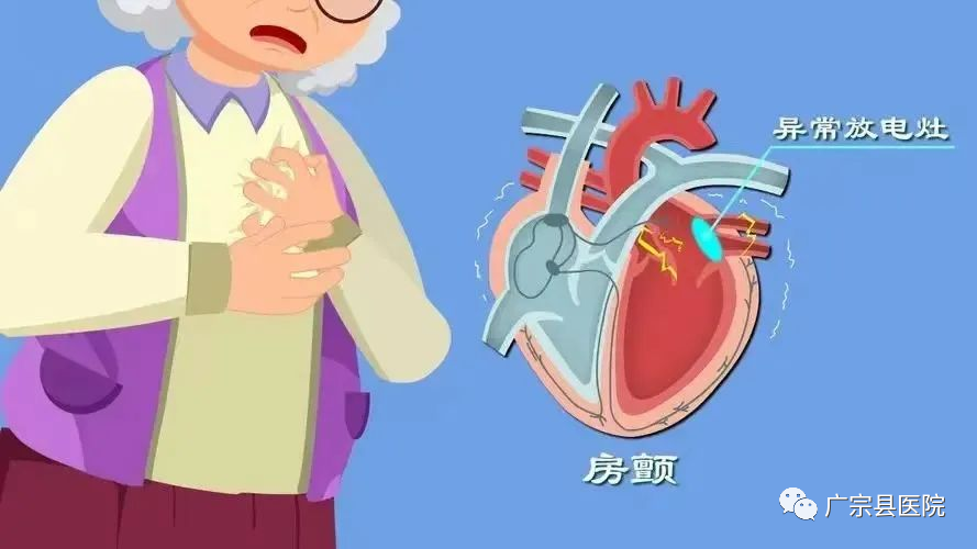 动态心电图接头怎么接小盒子，大智慧 —— 动态心电图知识普及_https://www.jmylbn.com_新闻资讯_第6张