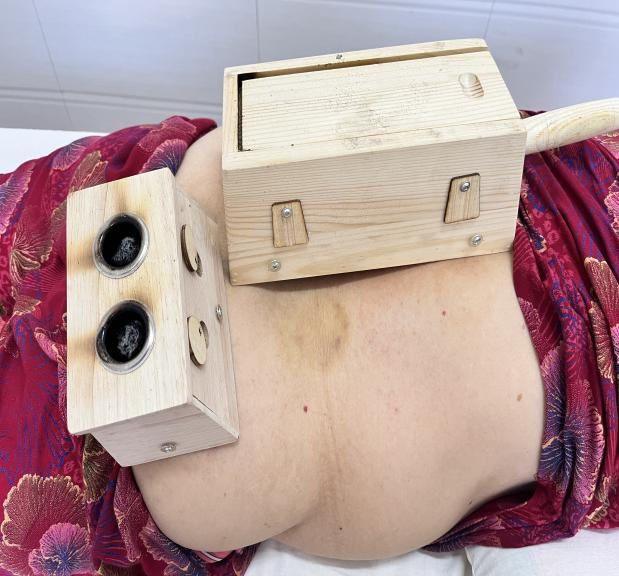 电针理疗是什么南安乡卫生院中医康复理疗门诊开诊啦！_https://www.jmylbn.com_新闻资讯_第6张