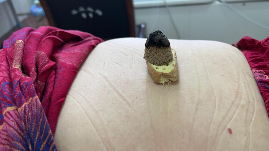 电针理疗是什么南安乡卫生院中医康复理疗门诊开诊啦！_https://www.jmylbn.com_新闻资讯_第8张