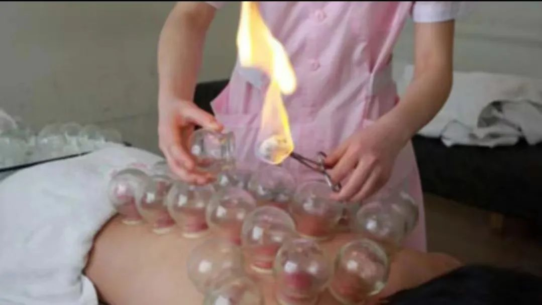 电针理疗是什么南安乡卫生院中医康复理疗门诊开诊啦！_https://www.jmylbn.com_新闻资讯_第9张