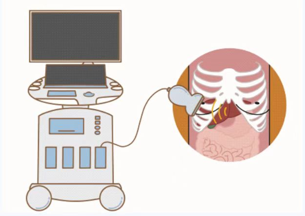b超为什么探头发热小探头，大秘密！你不知道的超声检查那些事儿……_https://www.jmylbn.com_新闻资讯_第4张