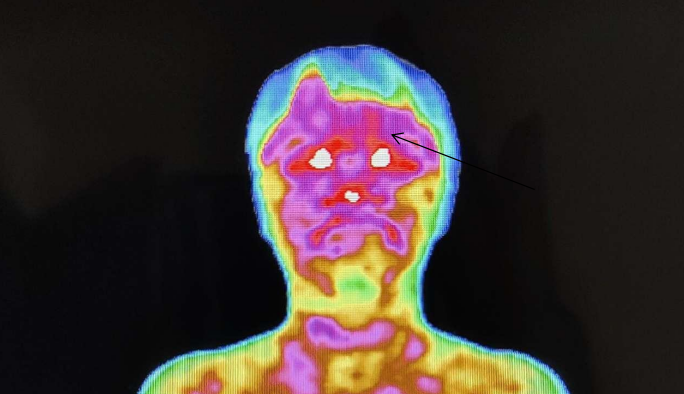 医用红外热像仪怎么开机零辐射，绿色体检－－红外热像检查，让中医可视化！_https://www.jmylbn.com_新闻资讯_第9张