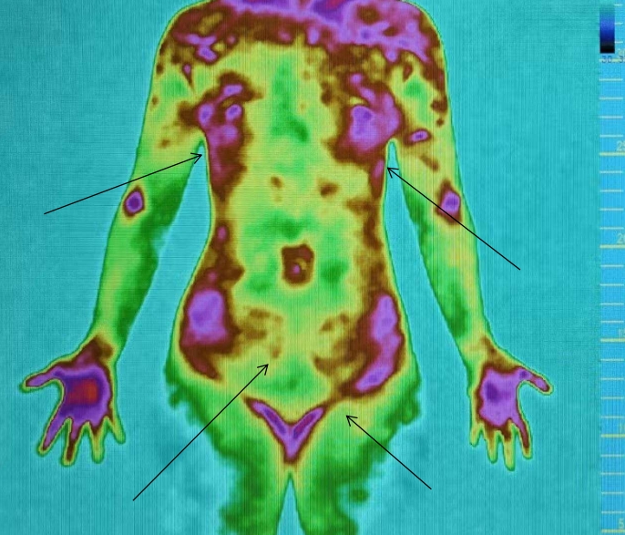 医用红外热像仪怎么开机零辐射，绿色体检－－红外热像检查，让中医可视化！_https://www.jmylbn.com_新闻资讯_第13张