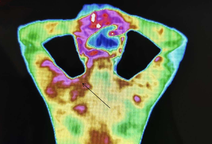 医用红外热像仪怎么开机零辐射，绿色体检－－红外热像检查，让中医可视化！_https://www.jmylbn.com_新闻资讯_第10张
