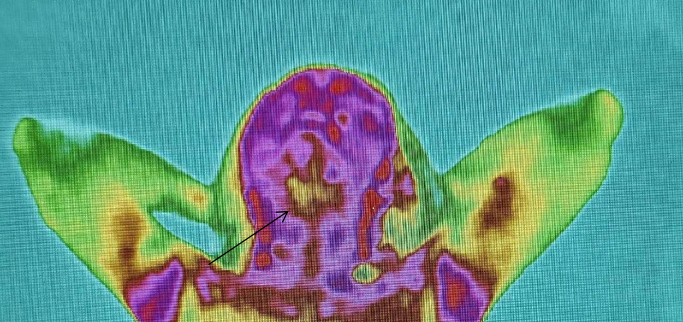 医用红外热像仪怎么开机零辐射，绿色体检－－红外热像检查，让中医可视化！_https://www.jmylbn.com_新闻资讯_第12张