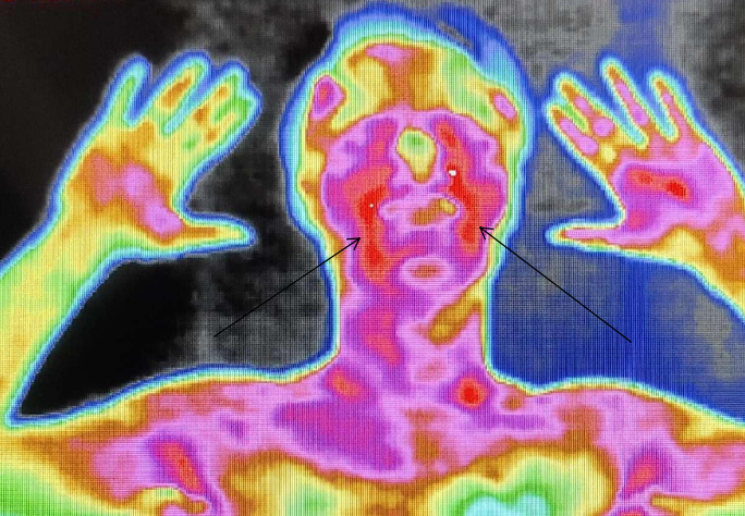 医用红外热像仪怎么开机零辐射，绿色体检－－红外热像检查，让中医可视化！_https://www.jmylbn.com_新闻资讯_第11张