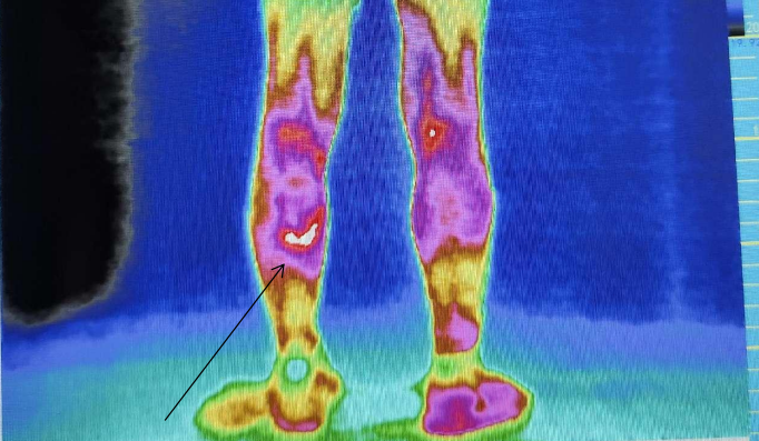 医用红外热像仪怎么开机零辐射，绿色体检－－红外热像检查，让中医可视化！_https://www.jmylbn.com_新闻资讯_第8张