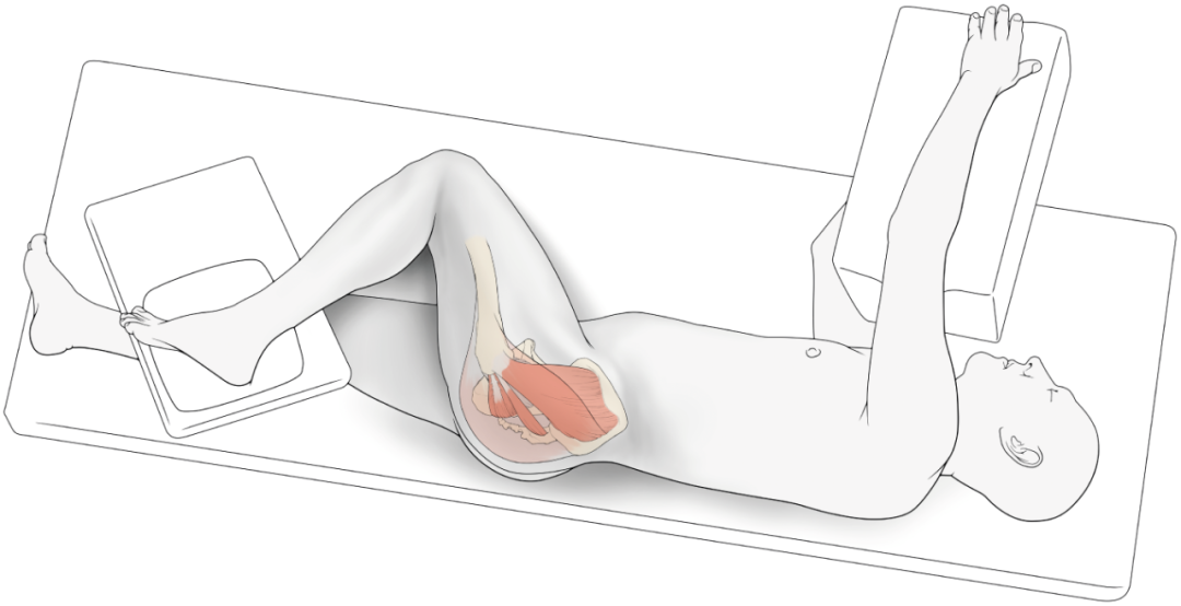 SuperPATH微创全髋关节置换手术入路图解