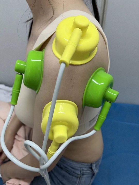 什么是中频干扰【小瑞康复说】康复理疗技术之“中频干扰电”的介绍_https://www.jmylbn.com_新闻资讯_第7张