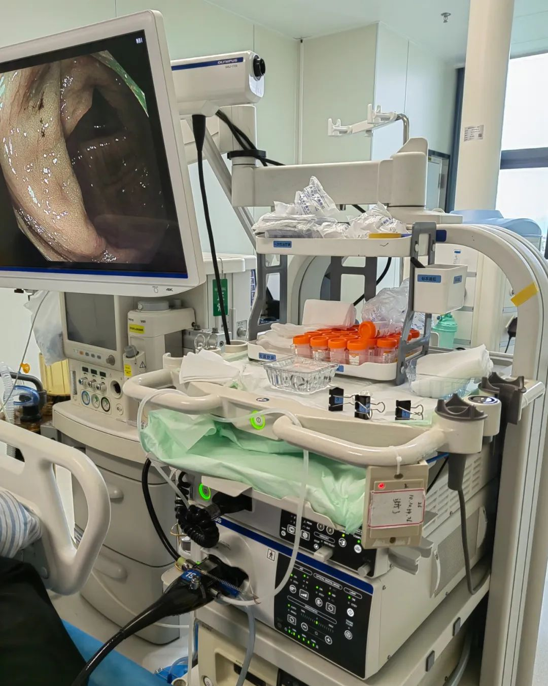 奥林巴斯内窥镜怎么样胃肠镜检查再添利器！奥林巴斯消化内镜X1(CV-1500)在龙华区中心医院正式启用_https://www.jmylbn.com_新闻资讯_第6张