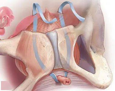尿道张力过强怎么办【国家区域医疗中心·名医在身边】填补空白！尿道无张力悬吊术、盆底修复术已在我院泌尿外科广泛开展_https://www.jmylbn.com_新闻资讯_第8张