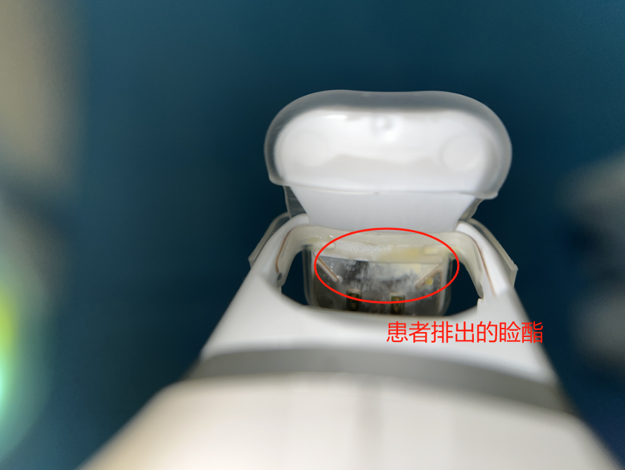 光热治疗仪有什么作用北京首台光热脉动复合治疗仪在我院正式开机，干眼诊疗新篇章正式开启_https://www.jmylbn.com_新闻资讯_第6张