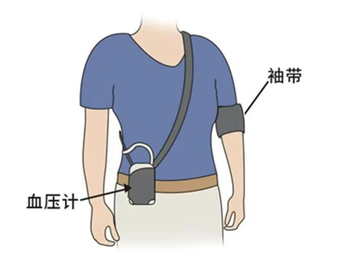 动态血压怎么佩带【健康知识】24小时动态血压监测，真实了解您的血压！_https://www.jmylbn.com_新闻资讯_第16张