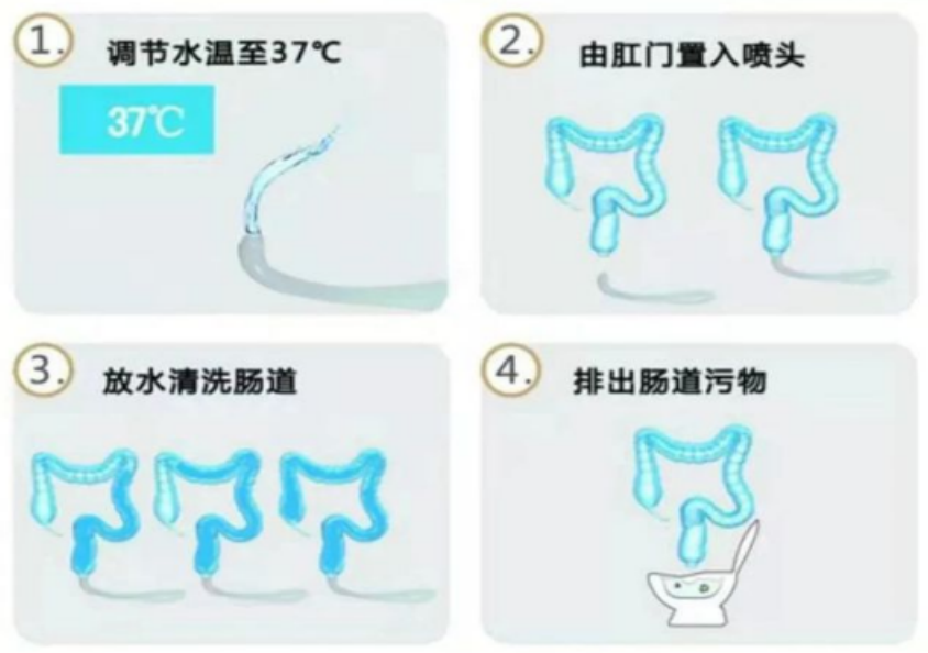 消化道动力检测怎么做双核护航消化道健康：结肠水疗联合胃肠动力检测，精准诊疗新选择_https://www.jmylbn.com_新闻资讯_第7张