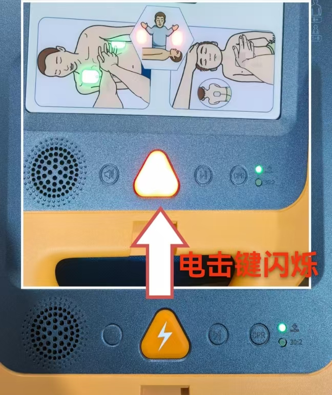 自动体外除颤器是什么“救命神器”--AED_https://www.jmylbn.com_新闻资讯_第10张