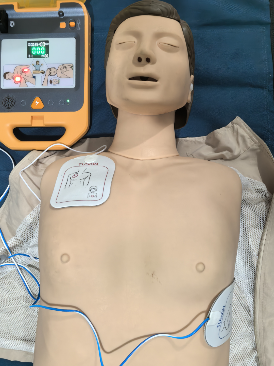 自动体外除颤器是什么“救命神器”--AED_https://www.jmylbn.com_新闻资讯_第9张