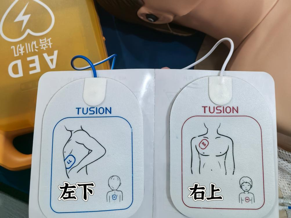 自动体外除颤器是什么“救命神器”--AED_https://www.jmylbn.com_新闻资讯_第8张