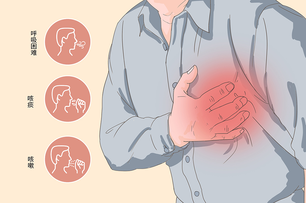 动态心电图仪器怎么看一文了解24小时动态心电图_https://www.jmylbn.com_新闻资讯_第5张