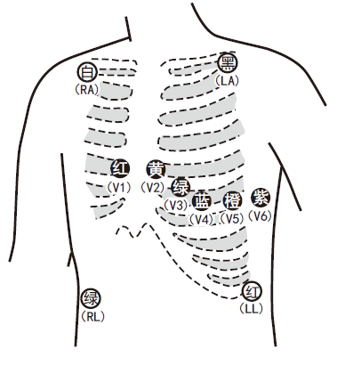 动态心电图仪器怎么看一文了解24小时动态心电图_https://www.jmylbn.com_新闻资讯_第8张