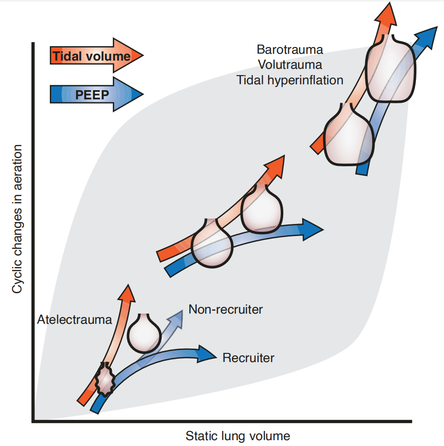 呼吸机ac是什么意思呼吸机导致的肺损伤和肺保护性通气_https://www.jmylbn.com_新闻资讯_第17张