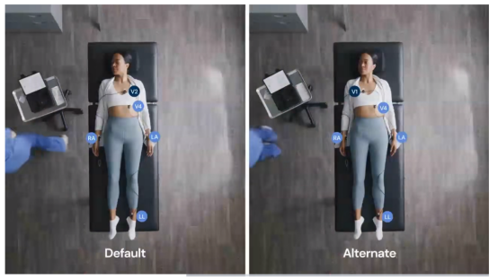 心电图机线怎么找只有“一条线”的心电图机！它是如何做到的？_https://www.jmylbn.com_新闻资讯_第17张