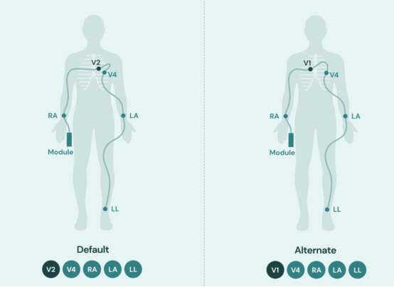 心电图机线怎么找只有“一条线”的心电图机！它是如何做到的？_https://www.jmylbn.com_新闻资讯_第18张