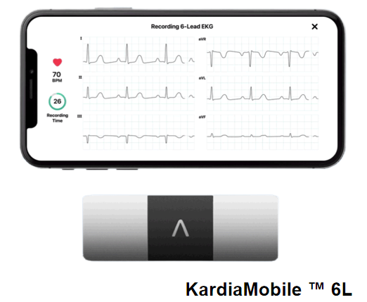 心电图机线怎么找只有“一条线”的心电图机！它是如何做到的？_https://www.jmylbn.com_新闻资讯_第13张