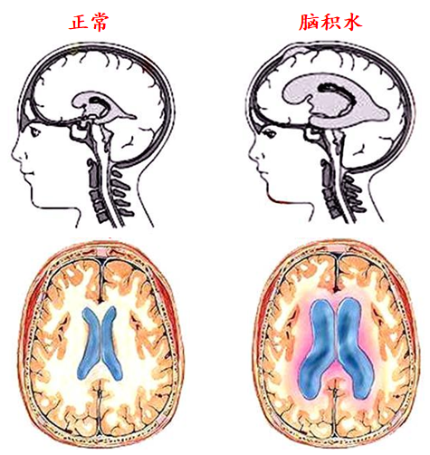 “腦子進水”怎么用有限元分析！！！的圖1