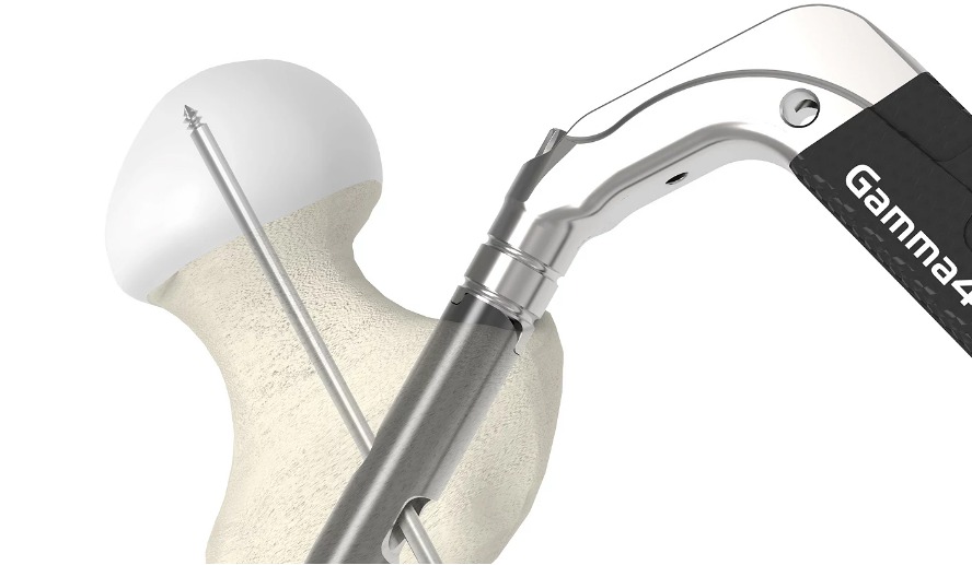 髓内钉有哪些厂家进军欧洲！史赛克髓内固定钉新品_https://www.jmylbn.com_新闻资讯_第4张