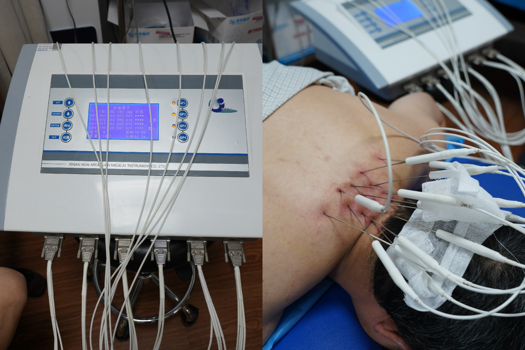 中医主治有哪些定向特色治疗 ｜ 不打针不吃药，绿色疗法见疗效——中医定向透药治疗_https://www.jmylbn.com_新闻资讯_第23张