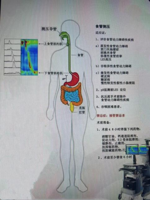 消化道动力检测怎么做反复胃肠不适找不到原因？来南安这家医院试试消化道动力检测_https://www.jmylbn.com_新闻资讯_第7张