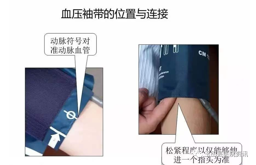 心电监护怎么测呼吸【科普专栏】心电监护仪的使用小知识（一）_https://www.jmylbn.com_新闻资讯_第3张