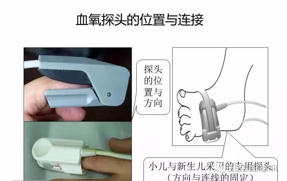 心电监测仪怎么看【科普专栏】心电监护仪的使用小知识（二）_https://www.jmylbn.com_新闻资讯_第6张