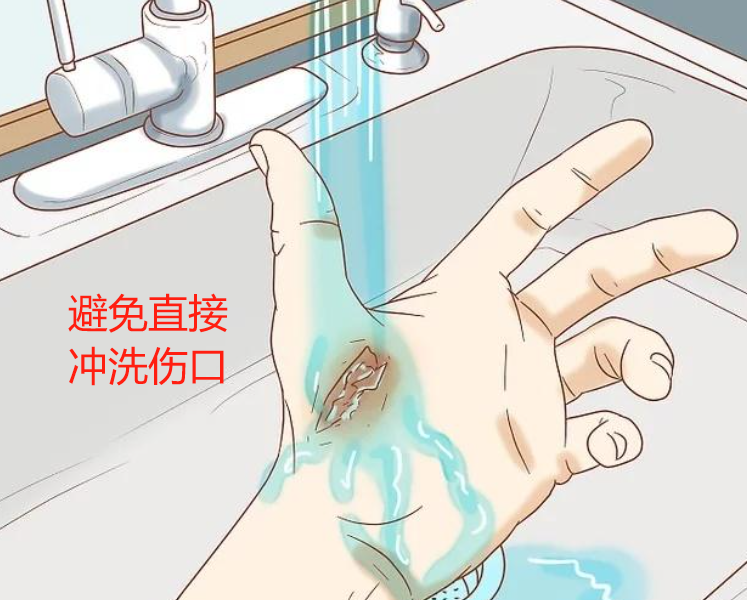 医用绷带怎么绑腹部《应急救援员》五级国家职业资格证书考试学习：外伤处理中5种绷带包扎方法、外伤止血方法及注意事项、气道异物梗阻的紧急处理等_https://www.jmylbn.com_新闻资讯_第10张