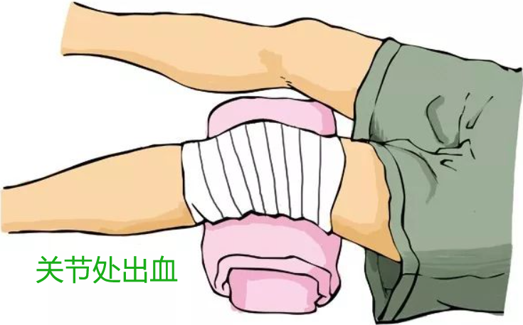 医用绷带怎么绑腹部《应急救援员》五级国家职业资格证书考试学习：外伤处理中5种绷带包扎方法、外伤止血方法及注意事项、气道异物梗阻的紧急处理等_https://www.jmylbn.com_新闻资讯_第4张