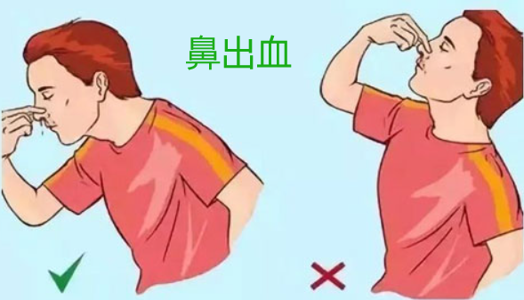 医用绷带怎么绑腹部《应急救援员》五级国家职业资格证书考试学习：外伤处理中5种绷带包扎方法、外伤止血方法及注意事项、气道异物梗阻的紧急处理等_https://www.jmylbn.com_新闻资讯_第3张