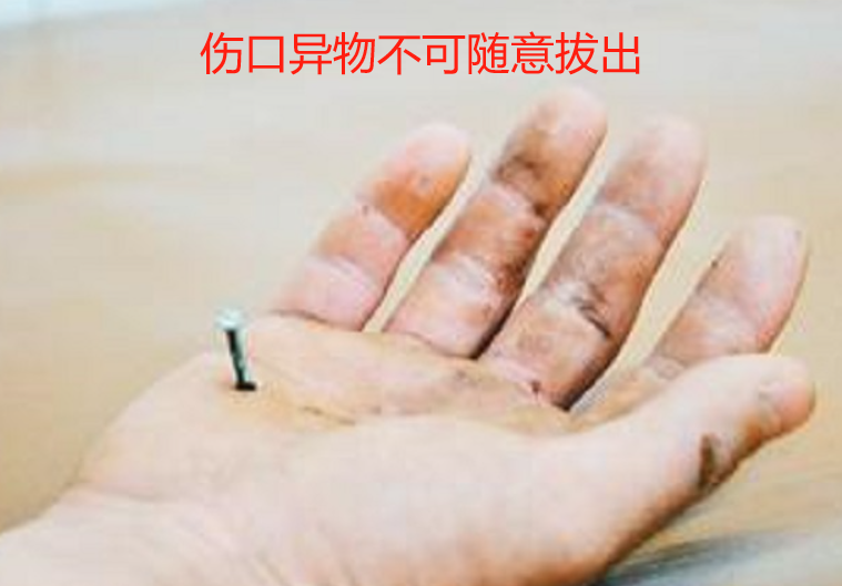 医用绷带怎么绑腹部《应急救援员》五级国家职业资格证书考试学习：外伤处理中5种绷带包扎方法、外伤止血方法及注意事项、气道异物梗阻的紧急处理等_https://www.jmylbn.com_新闻资讯_第6张