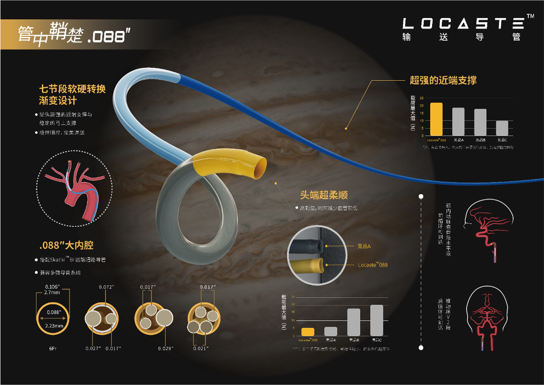 导管鞘怎么念有励可说｜Locaste长鞘及Skathi中间导管在基底动脉取栓术中的应用_https://www.jmylbn.com_新闻资讯_第6张