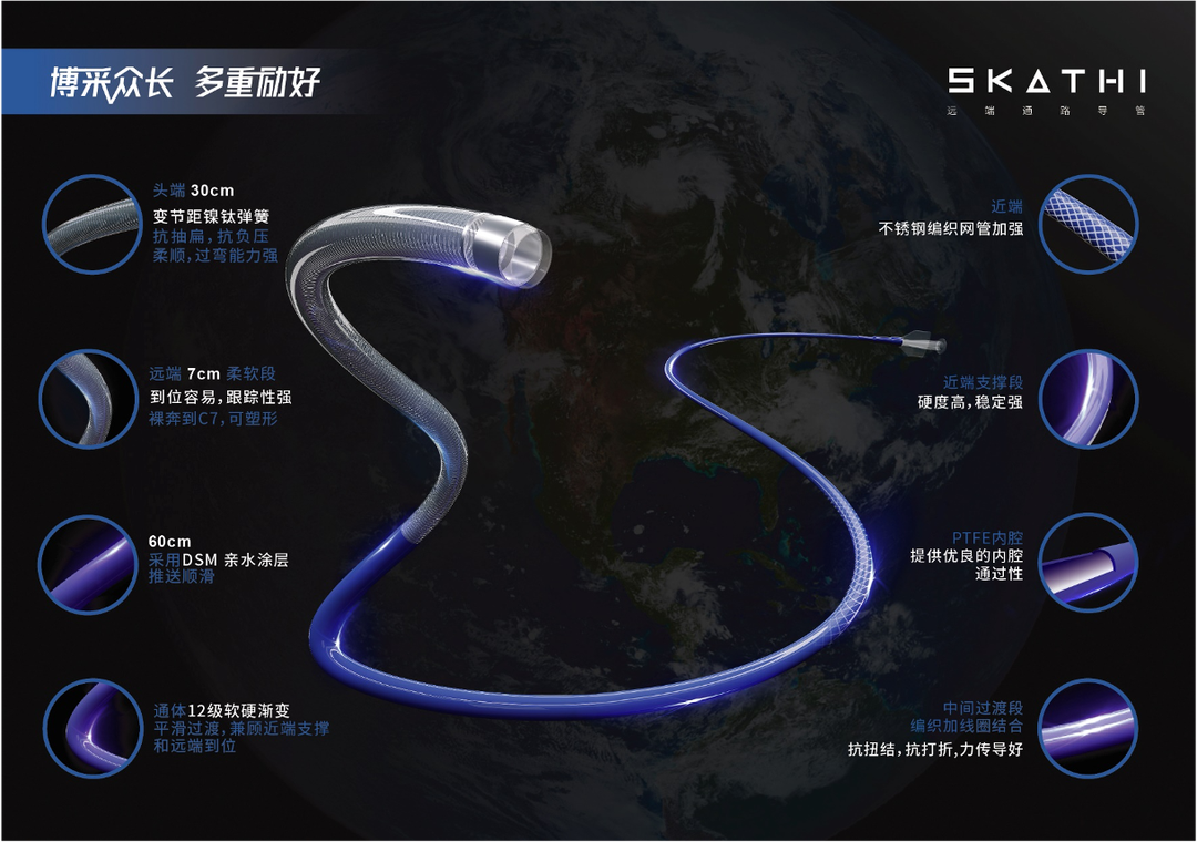 导管鞘怎么念有励可说｜Locaste长鞘及Skathi中间导管在基底动脉取栓术中的应用_https://www.jmylbn.com_新闻资讯_第7张