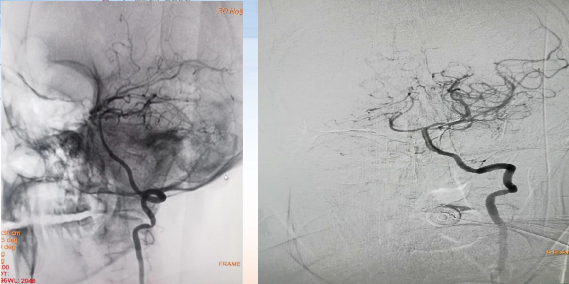 病历夹什么径技·第152期｜串联营病历夹：川陕大营_https://www.jmylbn.com_新闻资讯_第28张